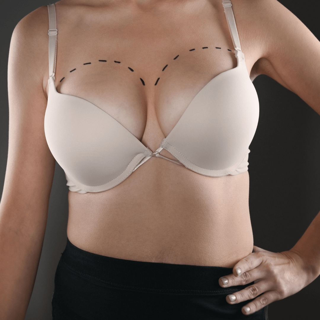 Breast Augmentation Columbia MD  Silicone and Saline Implants